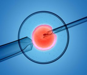 Infertility Treatment (OI,IUI,IVF,ICSI)