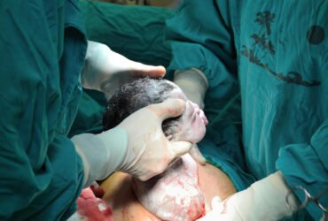 C-Section